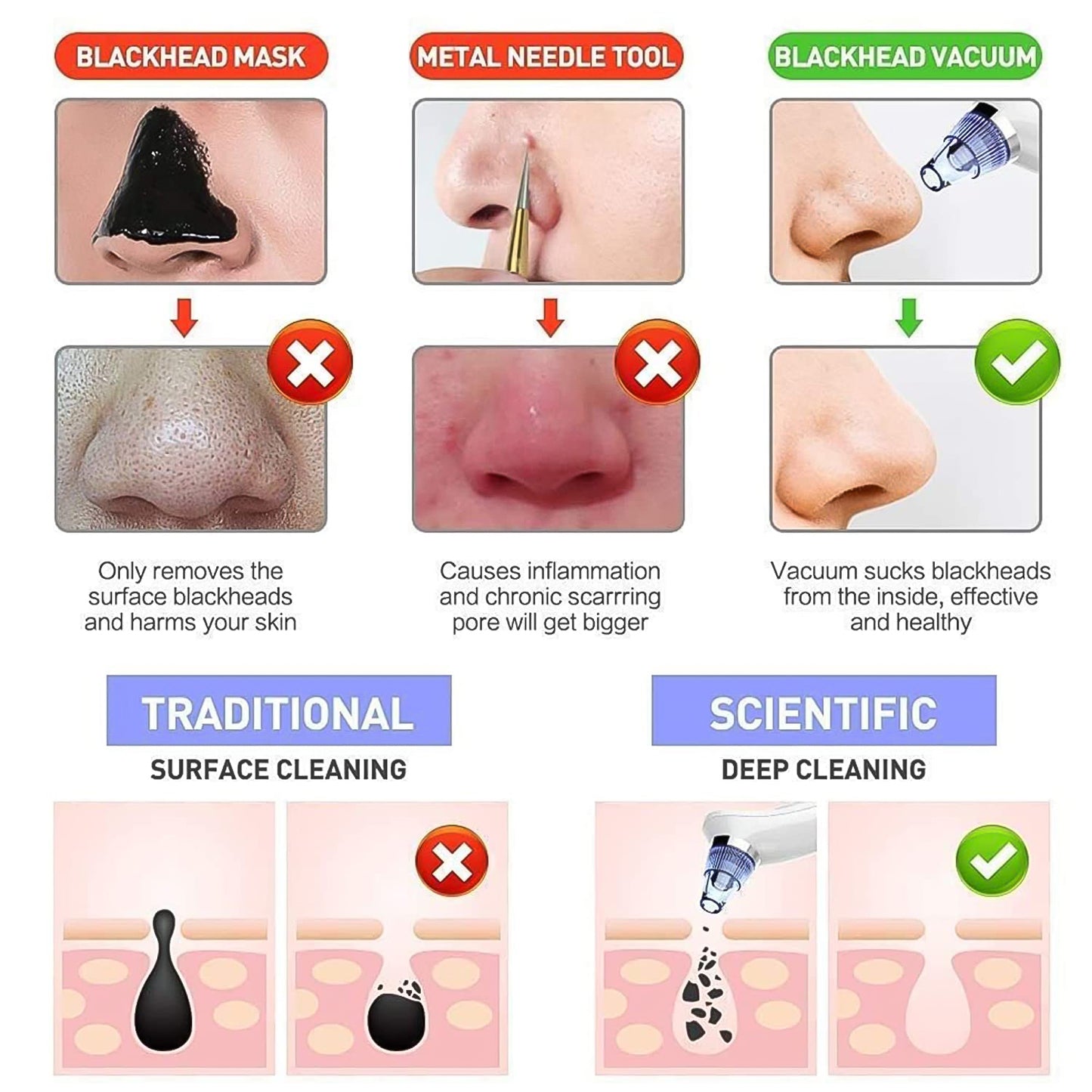 Vacuum Suction Tool With 4 Suction Head For Men And Women (Multi-color 1 Set) (Usb Adapter Included)