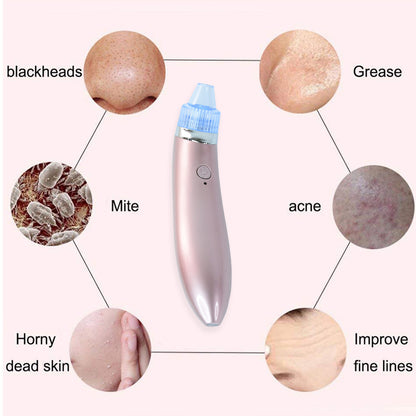 Vacuum Suction Tool With 4 Suction Head For Men And Women (Multi-color  1 Set) (Usb  Adapter Included)